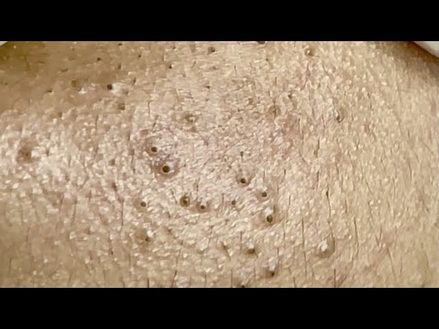 Satisfying video with Chung Vo Spa #134