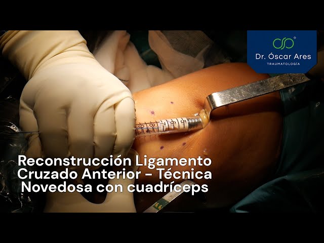 Reconstrucción Ligamento Cruzado Anterior  (Nueva Técnica con cuadríceps) - Dr. Ares